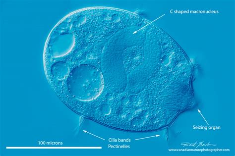   Didinium! Een Microscopischroofdier Met Een Onverwachte Voorkeur voor Andere Ciliaten.