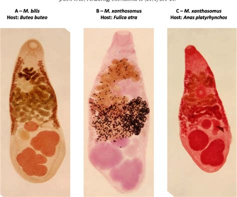  Metorchis! Een parasitaire platworm die zich thuis voelt in de galblaas van vogels